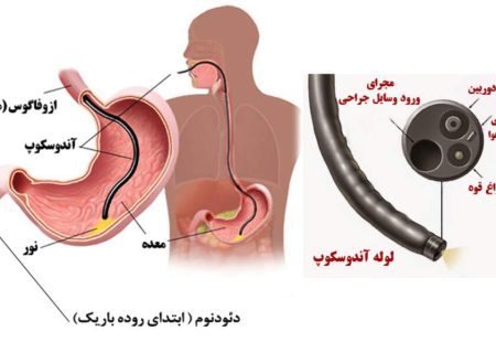 پیشرفته‌ترین دستگاه کلانژیوسکوپی در بیمارستان ابوعلی سینا شیراز